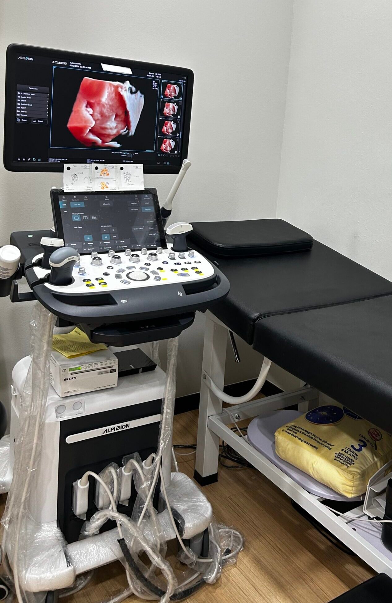 Klinik Dinara - Peralatan Ultrasound 5D Moden